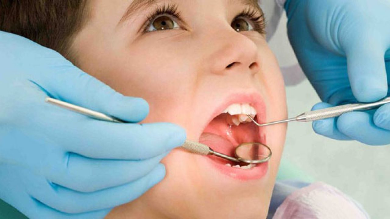 Những điều cần lưu ý để giúp bé thay răng đều và đẹp