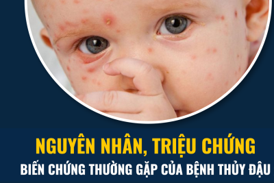 Nguyên nhân dẫn đến bệnh thủy đậu?