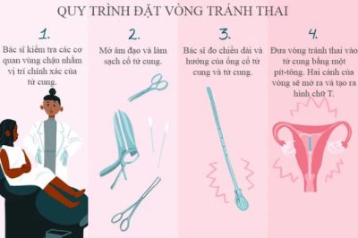 Quy trình đặt vòng tránh thai