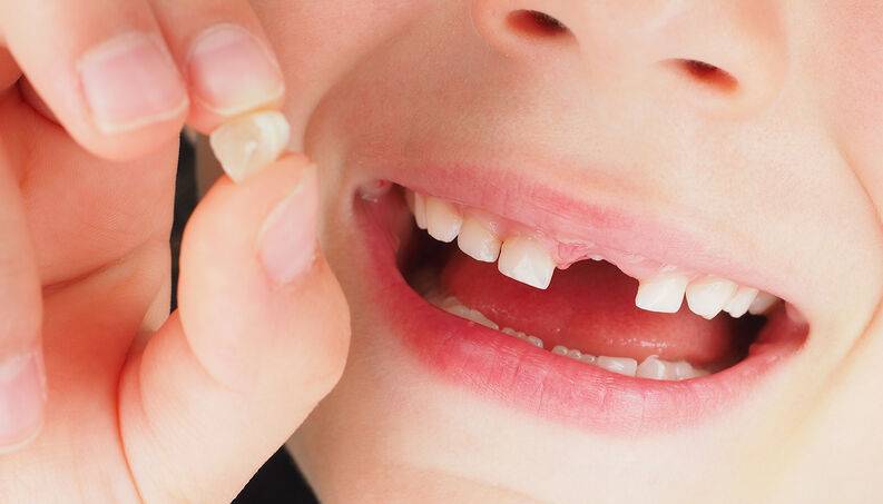 Những điều cần lưu ý để giúp bé thay răng đều và đẹp