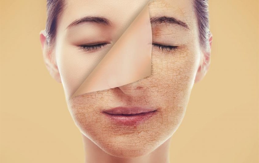 Bí Quyết Chăm Sóc Da Mùa đông Hiệu Quả