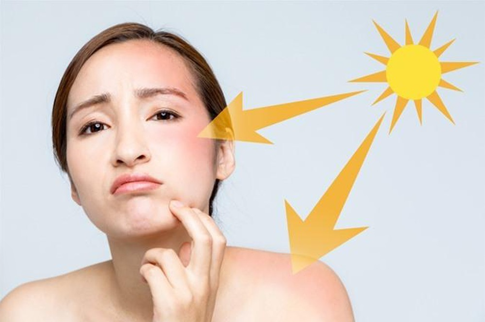 Tại Sao Cần Bôi Kem Chống Nắng