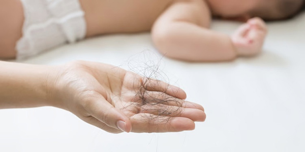 Các Phương Pháp Giúp Ngăn Ngừa Rụng Tóc Sau Sinh