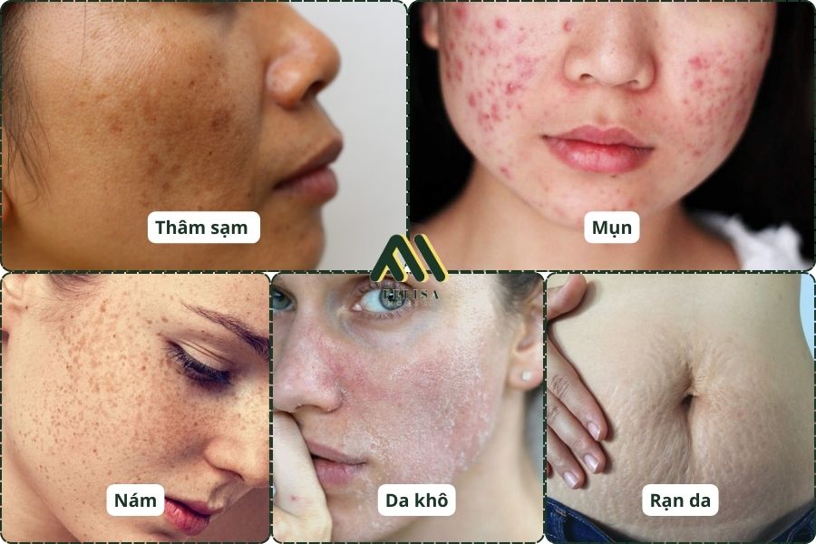 Tại Sao Mẹ Bỉm Cần Sản Phẩm Dưỡng Da An Toàn