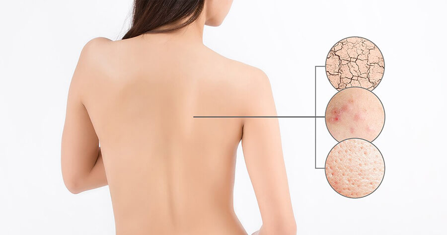 Lợi ích Của Việc Tẩy Tế Bào Chết Body
