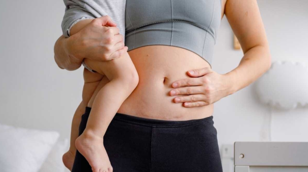 Hướng Dẫn Chăm Sóc Vết Mổ Sau Sinh