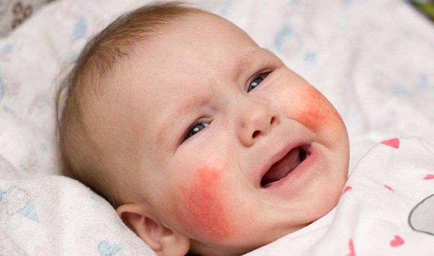 Có Nên Dùng Sản Phẩm Chăm Sóc Da Cho Trẻ Sơ Sinh