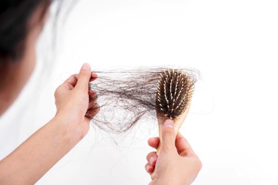Nguyên nhân rụng tóc sau sinh khiến nhiều mẹ gặp phải